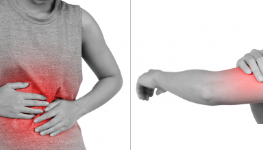 אישה עם סימן אדום בבטן ובזרוע כדי לסמל דלקת שיכולה לגרום לכאבים ולמחלות אחרות